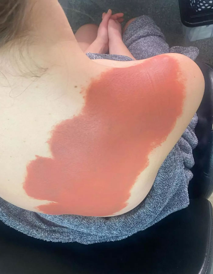 Makeup artist covers large tattoo on Claudia Jessie’s shoulder with skin-toned product. Makeup artist covers large tattoo on Claudia Jessie’s shoulder with skin-toned product.