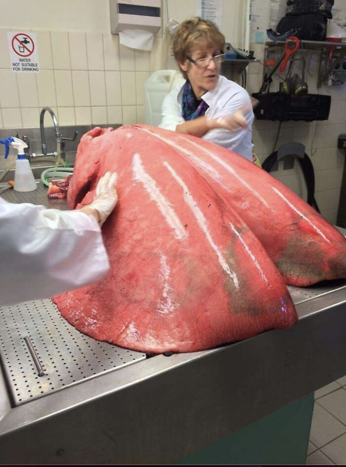 Large, raw lungs on a metal table with people in lab coats examining them, inspiring fear for those with megalophobia.
