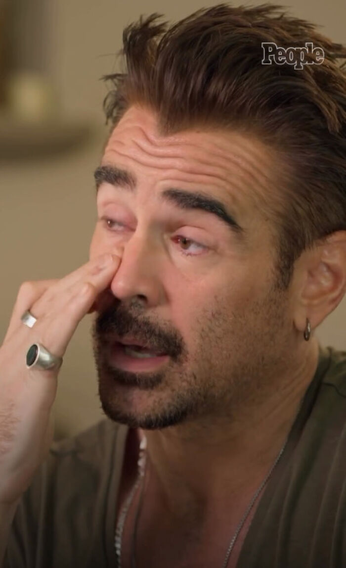 Colin Farrell In Tears As He Reveals Son’s Special Needs: “I Want The World To Be Kind To James” Colin Farrell In Tears As He Reveals Son’s Special Needs: “I Want The World To Be Kind To James”