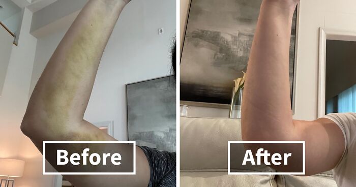 21 Before & Afters To Make You Do A Double Take