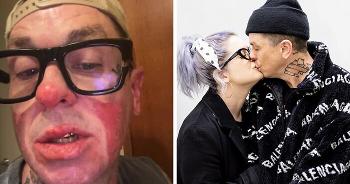 Kelly Osbourne Issues Warning After Boyfriend, Slipknot’s Sid Wilson, “Set Himself On Fire”