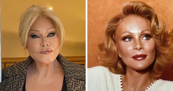 ‘Catwoman’ Jocelyn Wildenstein Reveals Her Original Face In Stunning Throwback Post