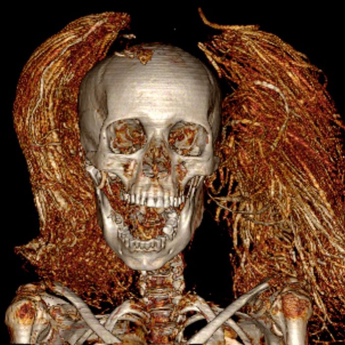 “So Horrible”: Virtual Autopsy Reveals Ancient Egyptian Mummy’s Heart-Wrenching Secret “So Horrible”: Virtual Autopsy Reveals Ancient Egyptian Mummy’s Heart-Wrenching Secret