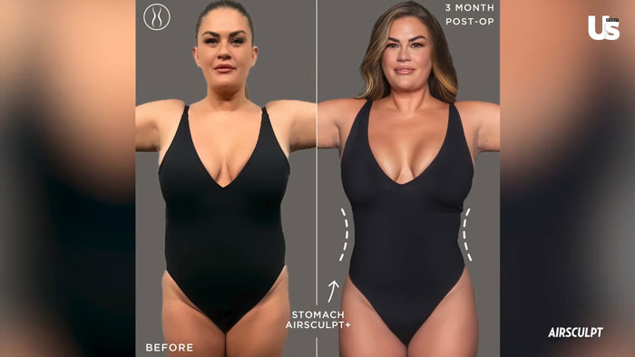 Brittany Cartwright Reveals She Got A "Revenge Body" Liposuction Before Filing For Divorce Brittany Cartwright Reveals She Got A "Revenge Body" Liposuction Before Filing For Divorce