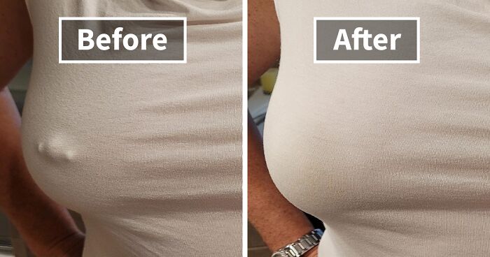 You’re Not Alone: 22 Relatable Body Problems (And How To Fix Them)