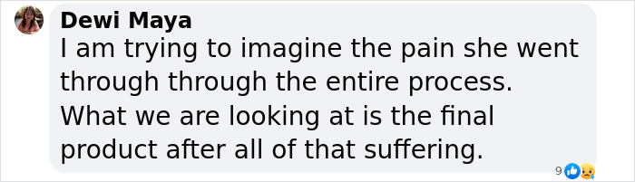 "Finally Beautiful": Japanese Model Becomes Unrecognizable After 20+ Plastic Surgeries "Finally Beautiful": Japanese Model Becomes Unrecognizable After 20+ Plastic Surgeries