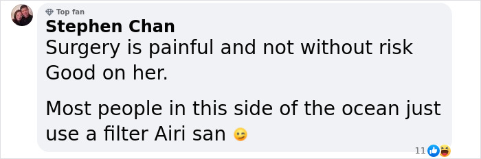 "Finally Beautiful": Japanese Model Becomes Unrecognizable After 20+ Plastic Surgeries "Finally Beautiful": Japanese Model Becomes Unrecognizable After 20+ Plastic Surgeries