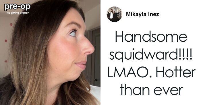 Woman Stuns Viewers With Surgery Results After Having Her “Jaw Of An 80-Year-Old” Fixed