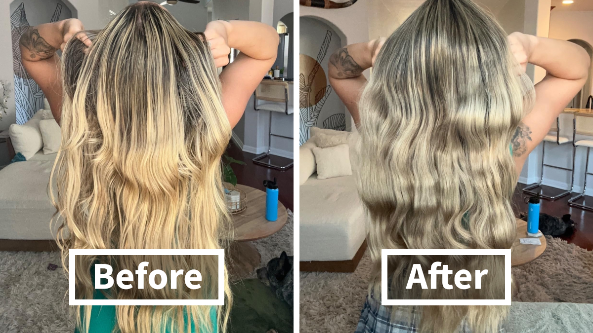 We’re Not Blushing Anymore: 18 Fixes For Those Embarrassing Body Probs