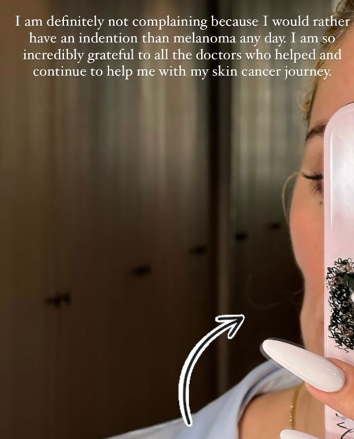 Khloé Kardashian Shares Before-and-After Pics of Facial Injections After Removing Tumor From Cheek Khloé Kardashian Shares Before-and-After Pics of Facial Injections After Removing Tumor From Cheek