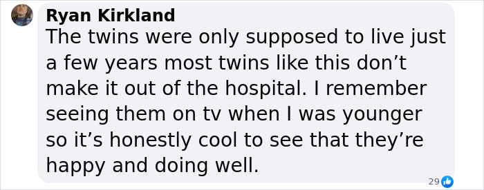 “They Deserve Happiness”: Conjoined Twins Abby And Brittany Seen In Rare Photo With Abby's Husband “They Deserve Happiness”: Conjoined Twins Abby And Brittany Seen In Rare Photo With Abby's Husband