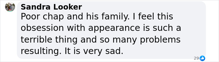 Man Takes His Own Life After Real Estate Agent Poses As Surgeon And Performs Beard Transplant Man Takes His Own Life After Real Estate Agent Poses As Surgeon And Performs Beard Transplant