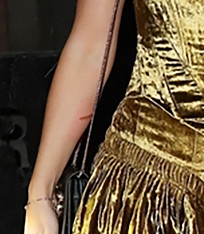 Taylor Swift Sparks Concern As Fans Spot Alarming Detail After Date Night With Travis Kelce Taylor Swift Sparks Concern As Fans Spot Alarming Detail After Date Night With Travis Kelce