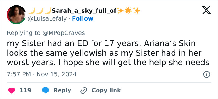 Ariana Grande Sparks New Health Concerns After Appearance At London Premiere Of ‘Wicked’ Ariana Grande Sparks New Health Concerns After Appearance At London Premiere Of ‘Wicked’