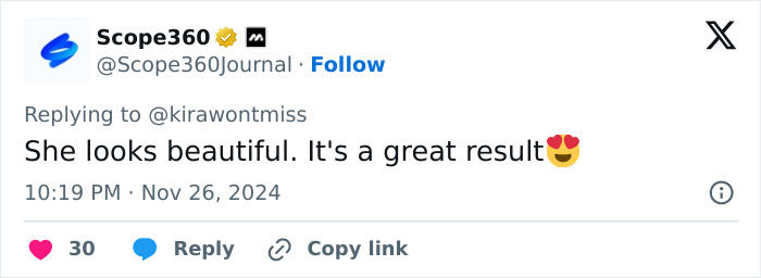 'Euphoria' Star Barbie Ferreira Looks “Unrecognizable” After Weight Loss, Sparks Ozempic Rumors 'Euphoria' Star Barbie Ferreira Looks “Unrecognizable” After Weight Loss, Sparks Ozempic Rumors