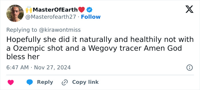 'Euphoria' Star Barbie Ferreira Looks “Unrecognizable” After Weight Loss, Sparks Ozempic Rumors 'Euphoria' Star Barbie Ferreira Looks “Unrecognizable” After Weight Loss, Sparks Ozempic Rumors