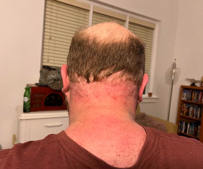 I Went To Get My Hair Cut By Mom Who, Hours Earlier, Said She Went To The Eye Doctor And Wasn’t Sure If She Could See Properly To Do It But Later On Assured Me She Could