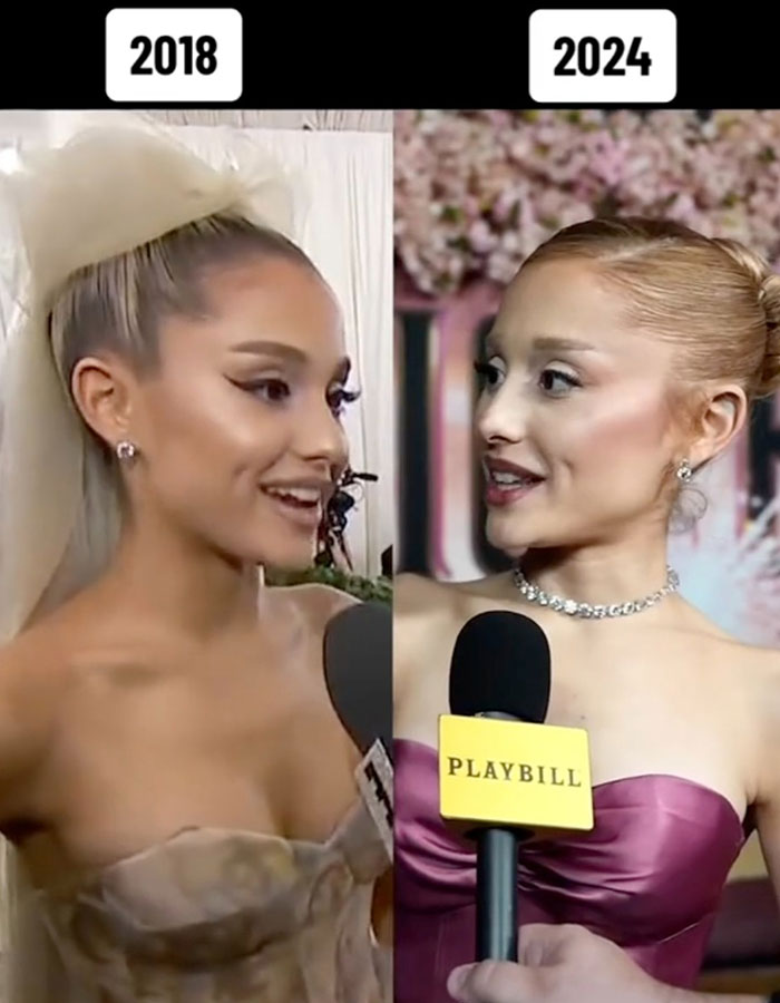 Ariana Grande Sparks New Health Concerns After Appearance At London Premiere Of ‘Wicked’ Ariana Grande Sparks New Health Concerns After Appearance At London Premiere Of ‘Wicked’