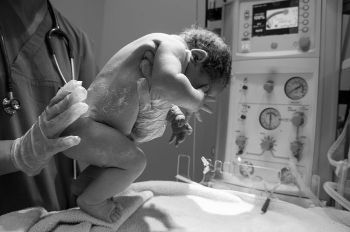 “It’s A Human Rights Issue”: After Doctor Costs Newborn’s Life With Her Long Nails, Expert Reacts “It’s A Human Rights Issue”: After Doctor Costs Newborn’s Life With Her Long Nails, Expert Reacts