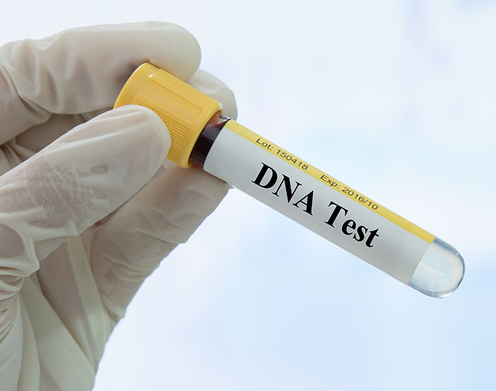 Man Takes DNA Test After Suspecting Child Is “Too Pretty” To Be His—Discovers Stunning Twist Man Takes DNA Test After Suspecting Child Is “Too Pretty” To Be His—Discovers Stunning Twist