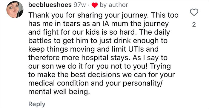 "Ashamed And Embarrassed": Man Without An Anus Reveals His Peculiar Bowel Habits "Ashamed And Embarrassed": Man Without An Anus Reveals His Peculiar Bowel Habits