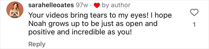 "Ashamed And Embarrassed": Man Without An Anus Reveals His Peculiar Bowel Habits "Ashamed And Embarrassed": Man Without An Anus Reveals His Peculiar Bowel Habits