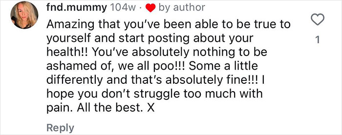"Ashamed And Embarrassed": Man Without An Anus Reveals His Peculiar Bowel Habits "Ashamed And Embarrassed": Man Without An Anus Reveals His Peculiar Bowel Habits