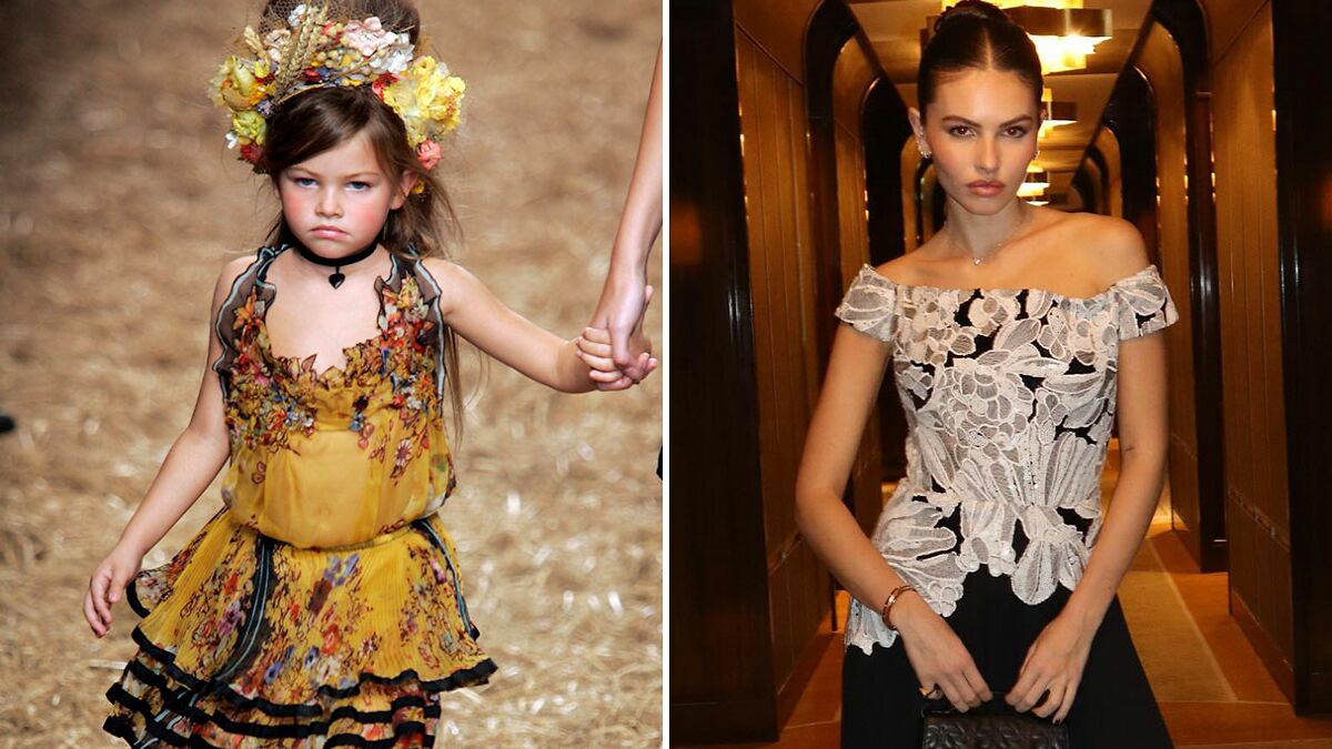 “I Feel Sorry For Her”: People React To New Photos Of World’s “Most Beautiful Girl”