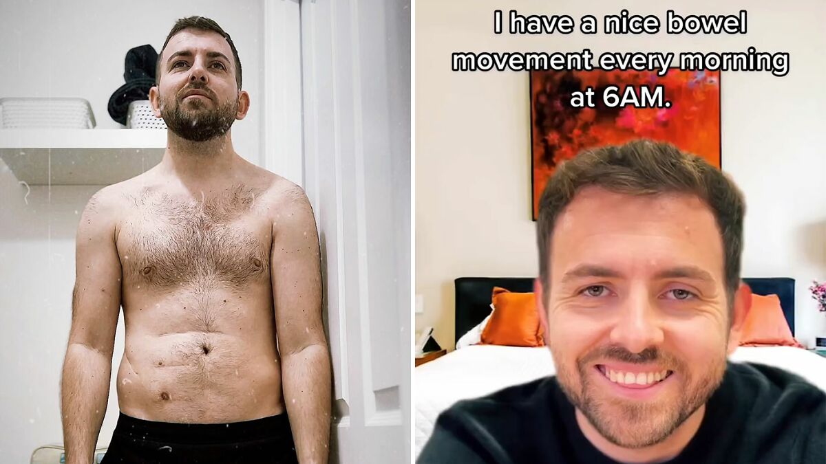 “Ashamed And Embarrassed”: Man Without An Anus Reveals His Peculiar Bowel Habits