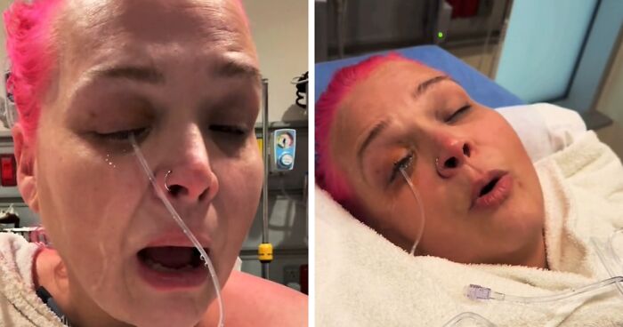 “I Started Screaming”: Woman Rushed To The Hospital After Mistaking Glue For Eye Drops