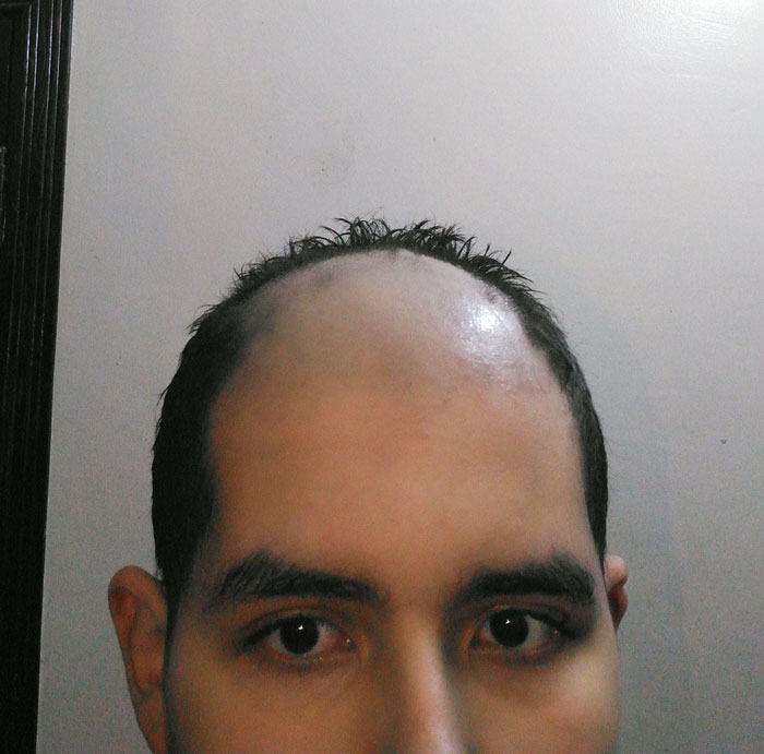 My Personal Hair Trimmer Broke While Using It Today