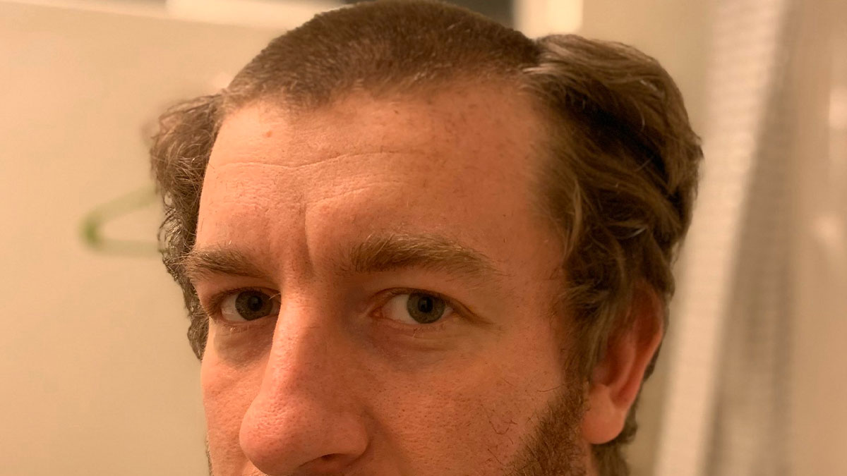 “3 Days Before My Wedding”: 50 Hilariously Tragic Hair Accidents