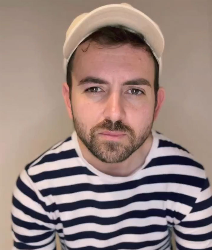 "Ashamed And Embarrassed": Man Without An Anus Reveals His Peculiar Bowel Habits "Ashamed And Embarrassed": Man Without An Anus Reveals His Peculiar Bowel Habits