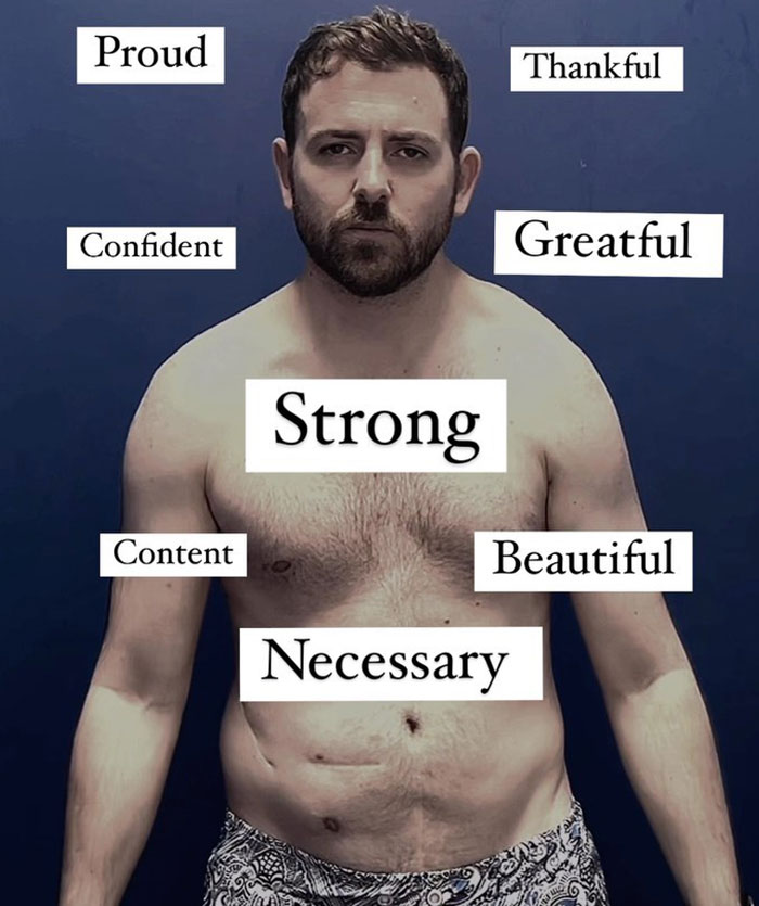 "Ashamed And Embarrassed": Man Without An Anus Reveals His Peculiar Bowel Habits "Ashamed And Embarrassed": Man Without An Anus Reveals His Peculiar Bowel Habits