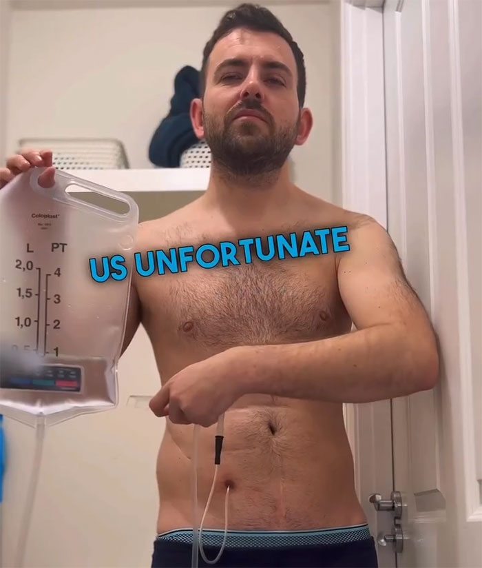 "Ashamed And Embarrassed": Man Without An Anus Reveals His Peculiar Bowel Habits "Ashamed And Embarrassed": Man Without An Anus Reveals His Peculiar Bowel Habits