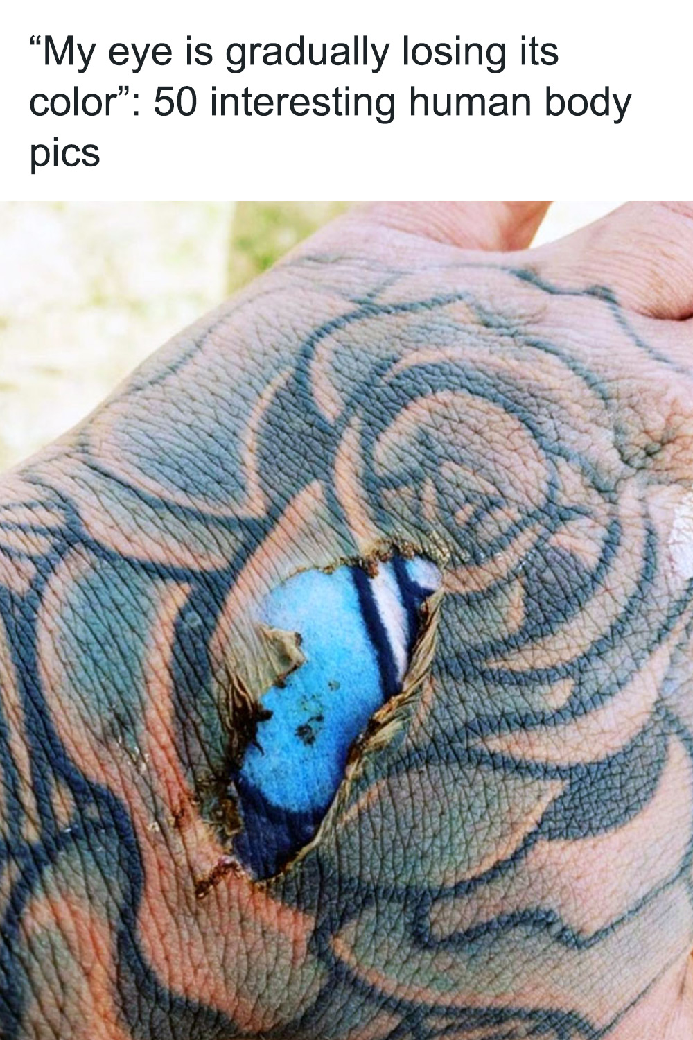 “My Eye Is Gradually Losing Its Color”: 50 Interesting Human Body Pics