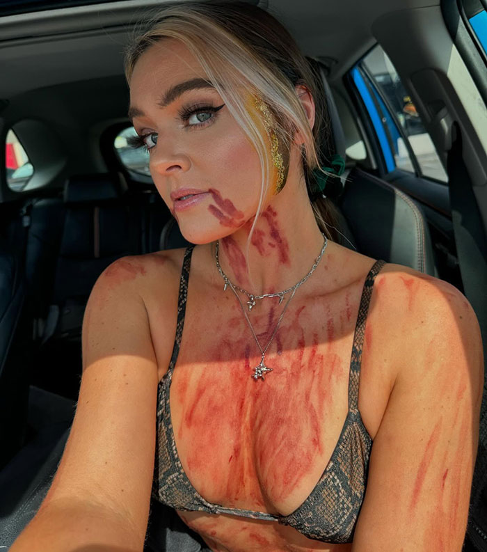 Notorious Vegan Activist Loses Defamation Case After Accusing Vet Of “Eating” Her Patients Notorious Vegan Activist Loses Defamation Case After Accusing Vet Of “Eating” Her Patients