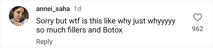 Comment questioning appearance with fillers and Botox, related to Millie Bobby Brown looks older. Comment questioning appearance with fillers and Botox, related to Millie Bobby Brown looks older.