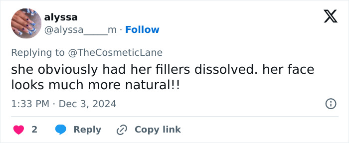 Tweet about Donatella Versace’s new face, with a comment on a natural look after dissolving fillers. Tweet about Donatella Versace’s new face, with a comment on a natural look after dissolving fillers.