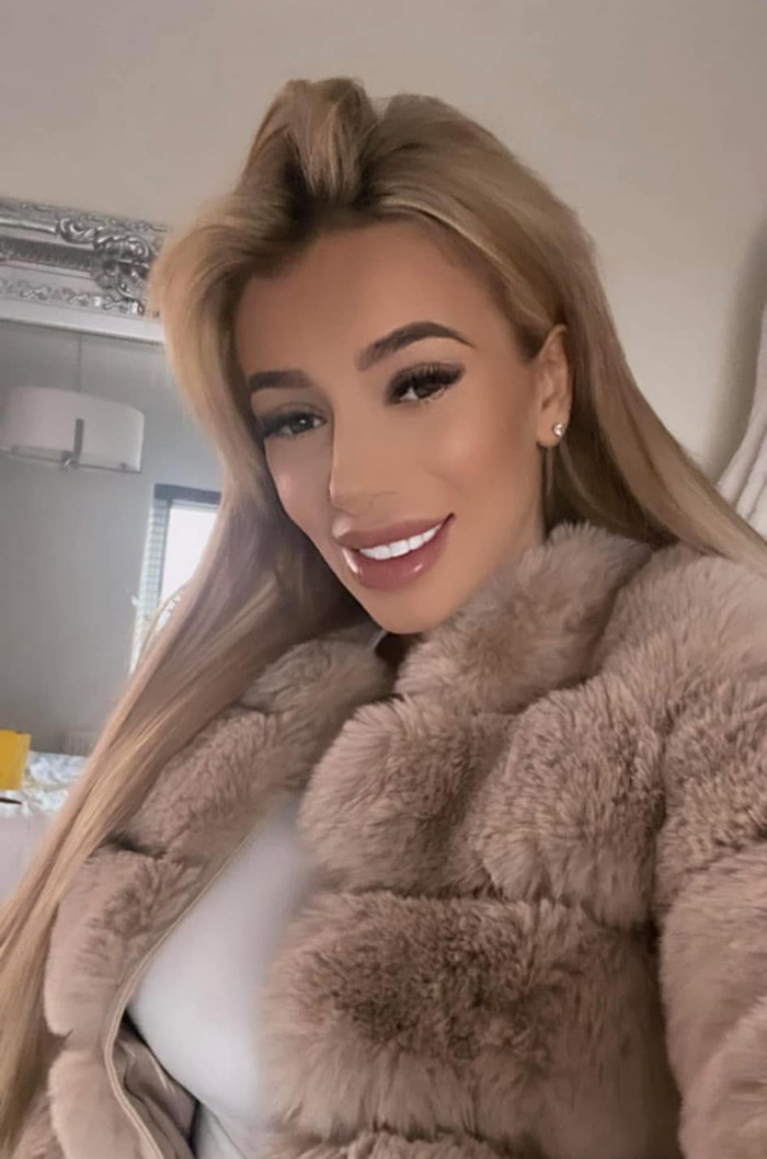 Demi Agoglia with long blonde hair, wearing a fur coat, related to BBL surgery incident. Demi Agoglia with long blonde hair, wearing a fur coat, related to BBL surgery incident.