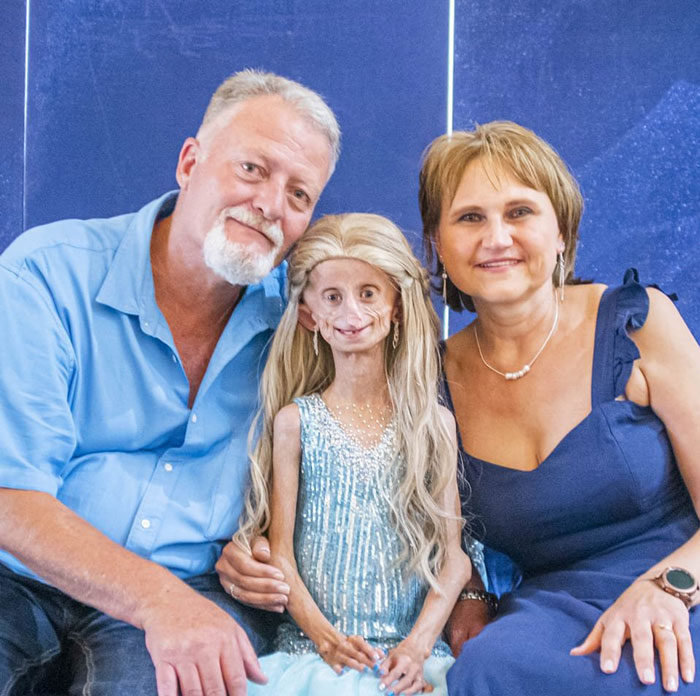 Teen Who Aged 8 Times Faster And Dreamed Of Marrying Passes Away Before Christmas Teen Who Aged 8 Times Faster And Dreamed Of Marrying Passes Away Before Christmas