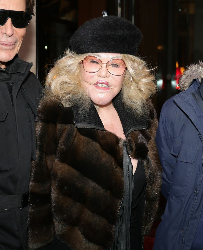“Jocelyn Wildenstein in Paris wearing a fur coat and beret, with her fiancé, highlighting smooth skin.” “Jocelyn Wildenstein in Paris wearing a fur coat and beret, with her fiancé, highlighting smooth skin.”