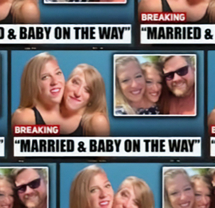 Speculation Surrounds Abby and Brittany Hensel After Unusual Video Emerges Speculation Surrounds Abby and Brittany Hensel After Unusual Video Emerges