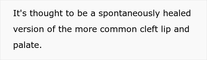 Text describing spontaneous healing of cleft lip defect, highlighting nature's fascinating impact on rare birth defects. Text describing spontaneous healing of cleft lip defect, highlighting nature's fascinating impact on rare birth defects.