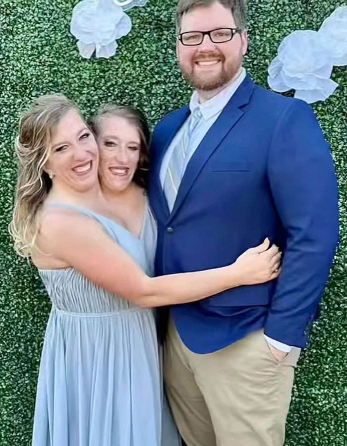 Speculation Surrounds Abby and Brittany Hensel After Unusual Video Emerges Speculation Surrounds Abby and Brittany Hensel After Unusual Video Emerges