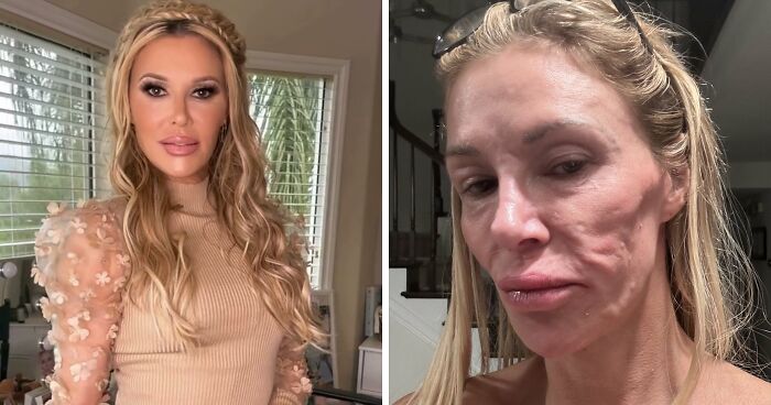 Brandi Glanville Raises Concern With Latest Social Media Selfie