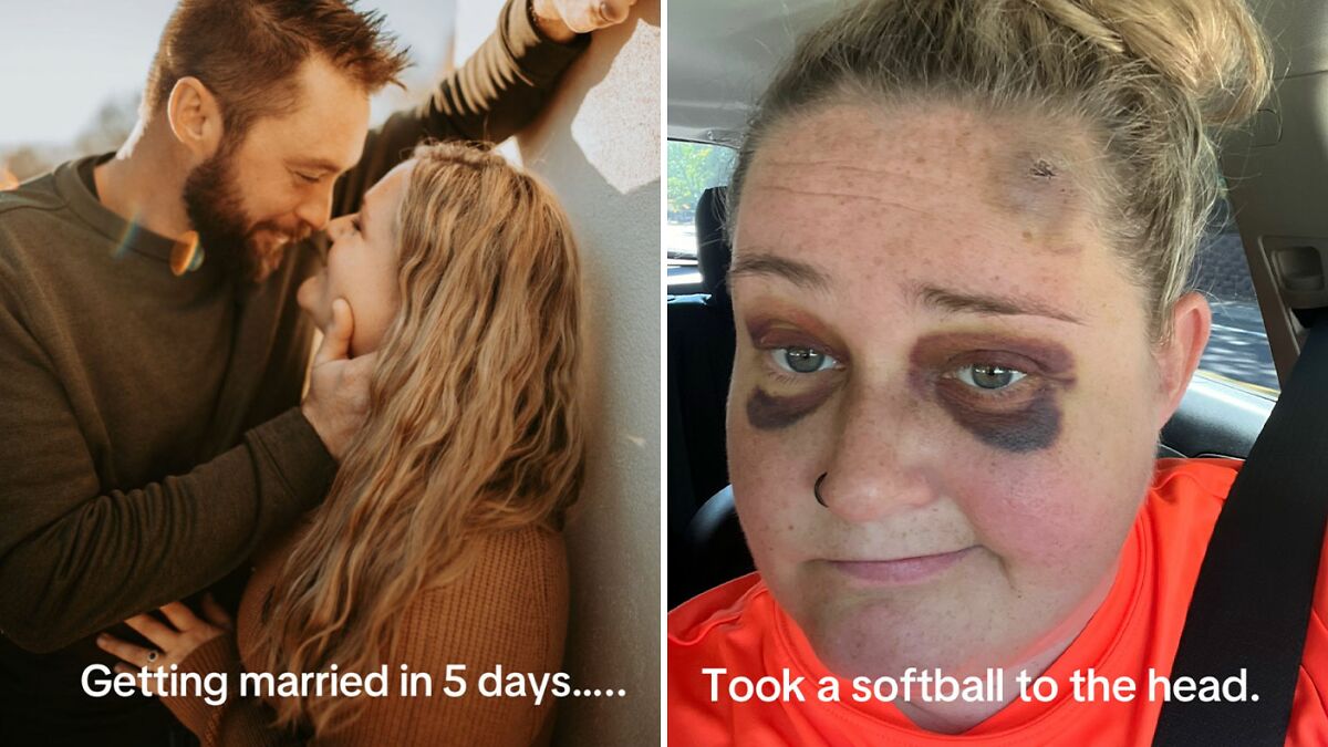 Netizens Say Makeup Artist “Nailed It” After Hiding Bride’s Facial Bruise 5 Days Before Wedding