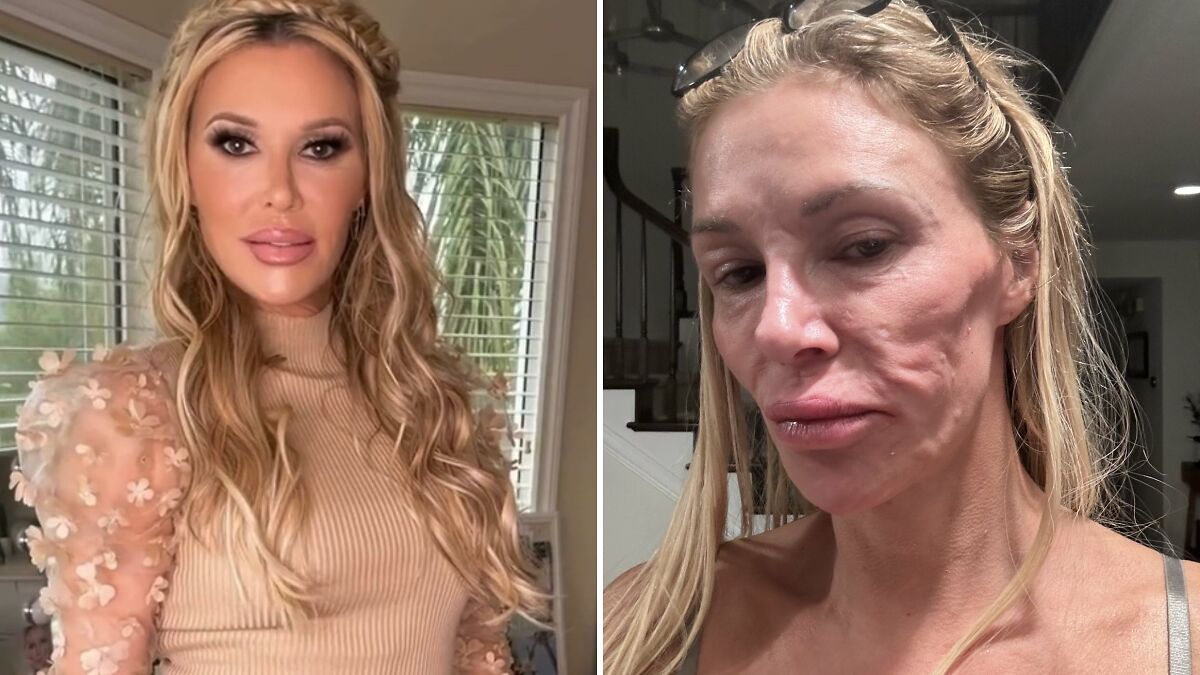 Brandi Glanville Raises Concern With Latest Social Media Selfie