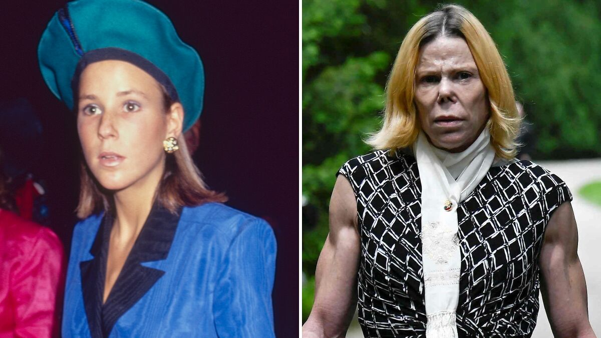 20 Stars Whose Dramatic Transformations Had Everyone Talking This Year