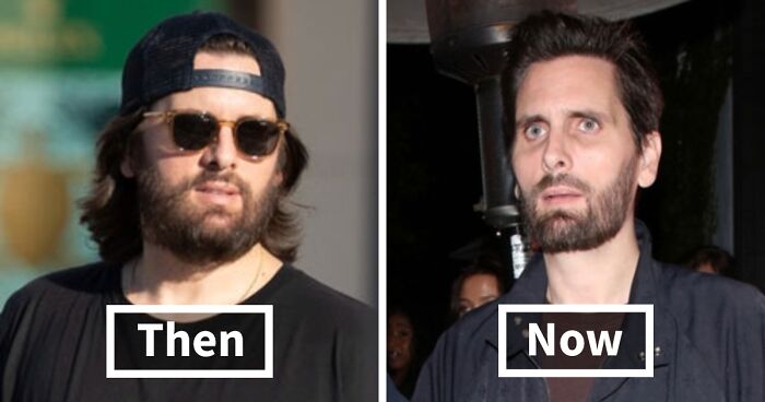 Celebrity Faces Show Alarming Effects Of Ozempic Use As Hollywood Grapples With New Beauty Fad